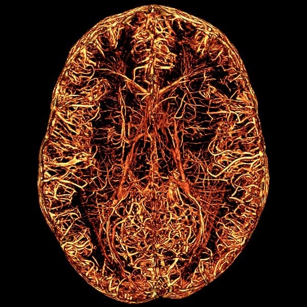 Your brain contains a complex network of blood vessels that keep it energized and healthy, including many small vessels that are very difficult to see on a typical brain scan. By injecting tiny iron oxide particles into the bloodstream and performing high-resolution Magnetic Resonance Imaging (MRI), we can display the 3D architecture of blood vessels in the human brain. This method helps researchers to understand the causes of various cognitive impairments. Image by Michaël Bernier from @usherbrooke